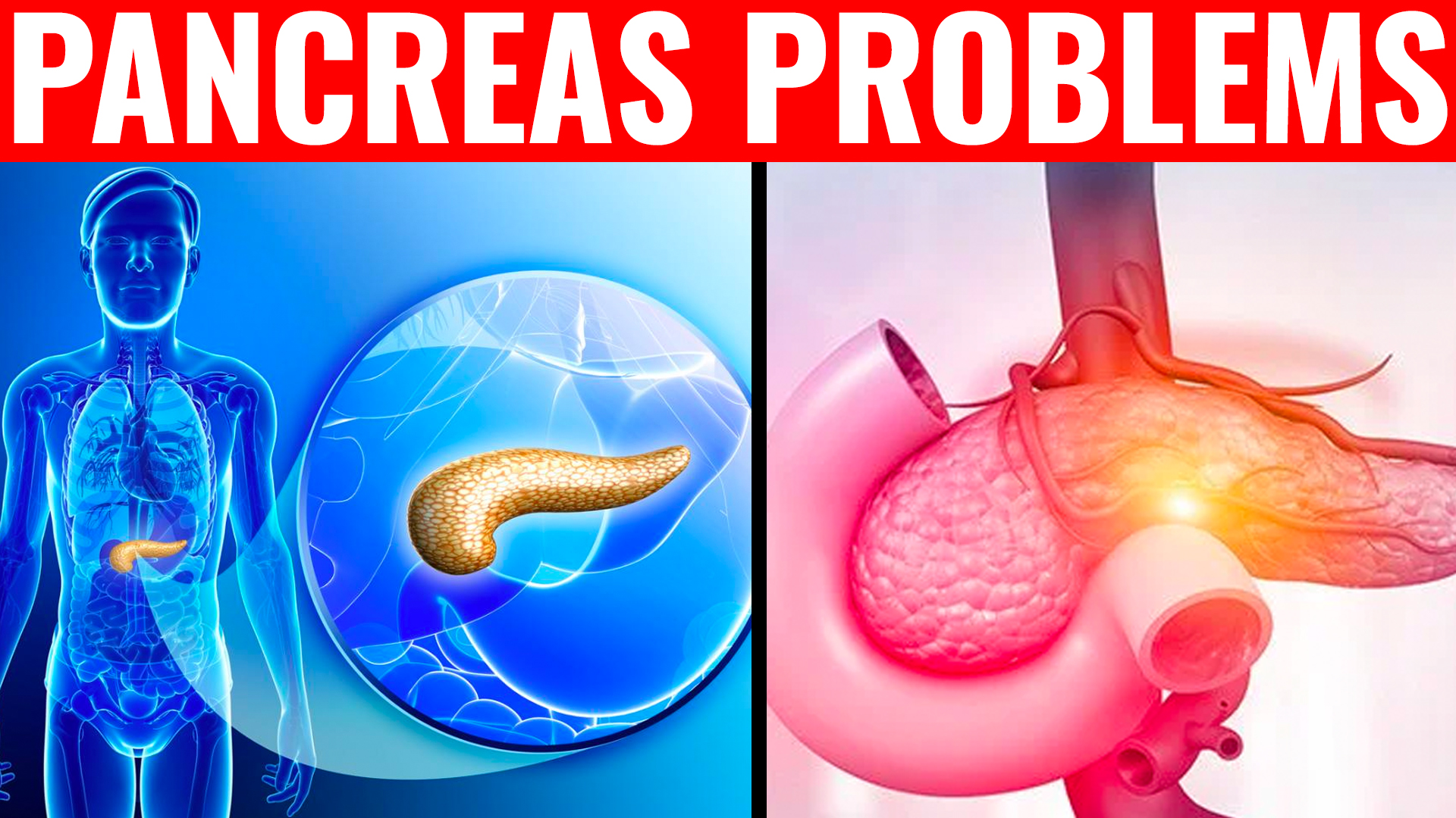 9 Signs Of Pancreas Problems And What To Do Against It